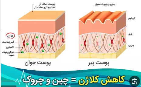  آمپول نوشیدنی کلاژن = معجون جوانساز